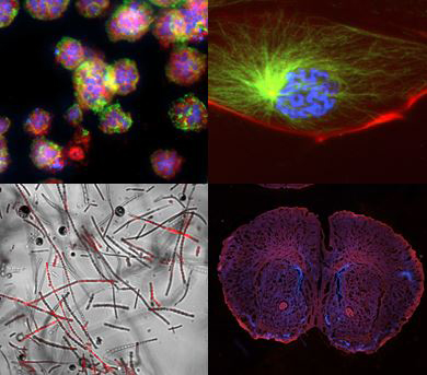 Four imaging modes, multiple imaging processes